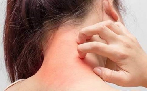 كورونا.. هذه العلامات الجديدة تدلّ على أنك مصاب بالفيروس "دون علمك" كورونا.. هذه العلامات الجديدة تدلّ على أنك مصاب بالفيروس "دون علمك"