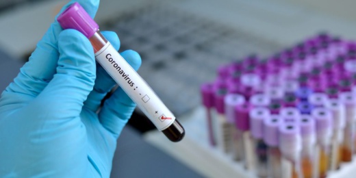 10 بالناظور.. التوزيع الجغرافي للإصابات الجديدة بفيروس كورونا في جهة الشرق 10 بالناظور.. التوزيع الجغرافي للإصابات الجديدة بفيروس كورونا في جهة الشرق