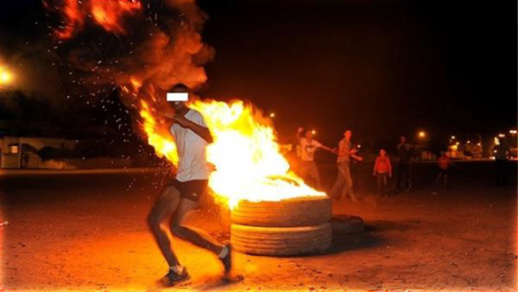 مآسي عاشوراء.. نيران "الشعالة" ترسل شابا إلى المستعجلات بين الحياة والموت مآسي عاشوراء.. نيران "الشعالة" ترسل شابا إلى المستعجلات بين الحياة والموت