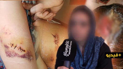 شاهدوا.. زوج يوجّه طعنات خطيرة لزوجته والأخيرة تناشد الأجهزة الأمنية والقضائية بالناظور اعتقاله