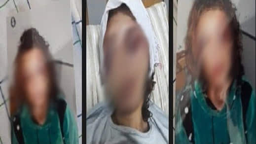 وتتواصل جرائم اغتصاب القاصرين.. إيقاف عشريني غرّر بقاصر بها عبر فايسبوك وهتك عرضها وتتواصل جرائم اغتصاب القاصرين.. إيقاف عشريني غرّر بقاصر بها عبر فايسبوك وهتك عرضها