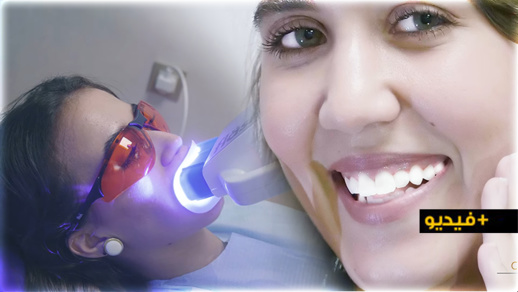 مع عيادة الشلالي تبيض الأسنان في 45 دقيقة فقط.. بتقنية وألة هي الأولى بالناظور مع عيادة الشلالي تبيض الأسنان في 45 دقيقة فقط.. بتقنية وألة هي الأولى بالناظور