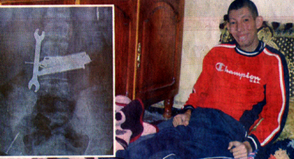 أدوات حديدية تهدد حياة معاق ذهنيا في وجدة أدوات حديدية تهدد حياة معاق ذهنيا في وجدة