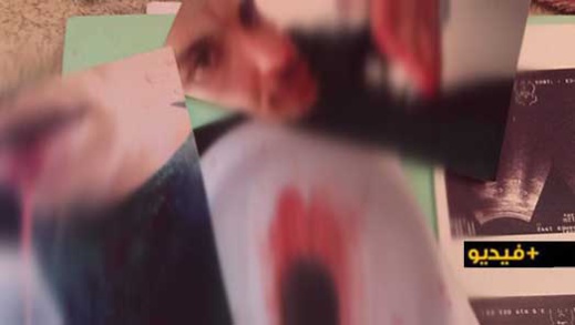 شاب من العروي يعاني من أمراض مزمنة يناشد المحسنين مساعدته في مصاريف العلاج