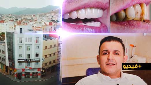 كفاءة وخبرة الدكتور عبد الله الشلالي تغير ابتسامة مهاجر ناظوري بعد نجاح عملية هوليود سمايل كفاءة وخبرة الدكتور عبد الله الشلالي تغير ابتسامة مهاجر ناظوري بعد نجاح عملية هوليود سمايل