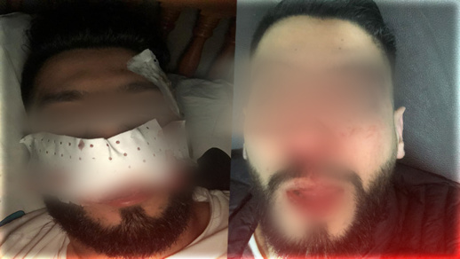 بعدما تسببوا في إصابات خطيرة لشاب.. الشرطة تعتقل أربعة عمال بمحل تجاري بشارع الجيش الملكي بعدما تسببوا في إصابات خطيرة لشاب.. الشرطة تعتقل أربعة عمال بمحل تجاري بشارع الجيش الملكي