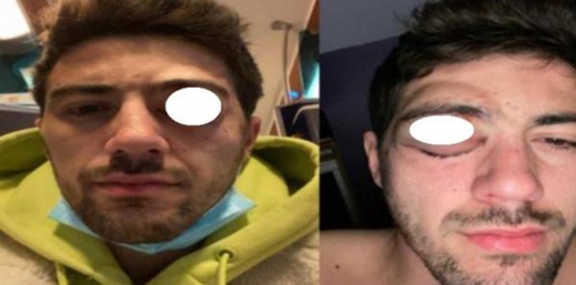 فنان مغربي يتعرض لاعتداء خطير من قبل 15 شخصا بفرنسا فنان مغربي يتعرض لاعتداء خطير من قبل 15 شخصا بفرنسا