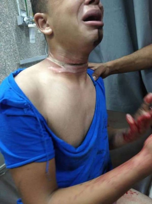 في ظل الأزمة الخانقة في الجهة الشرقية.. شاب يذبح عنقه بعد حجز دراجته ثلاثية العجلات في ظل الأزمة الخانقة في الجهة الشرقية.. شاب يذبح عنقه بعد حجز دراجته ثلاثية العجلات