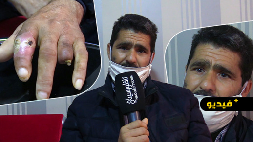 مؤثر.. بحار بمدينة الناظور تنقلب حياته رأسا على عقب بعد إصابته بمرض السكري مؤثر.. بحار بمدينة الناظور تنقلب حياته رأسا على عقب بعد إصابته بمرض السكري