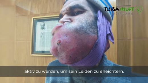 شاهدوا.. خمسيني من الناظور يخوض معركة قاسية ضد السرطان 