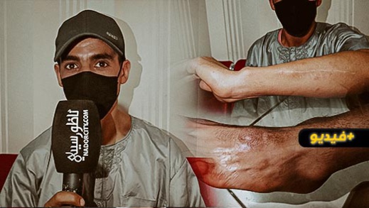 رب أسرة بحي بوبلاو يعاني بعد الاعتداء عليه ويناشد السلطات القبض على الجناة