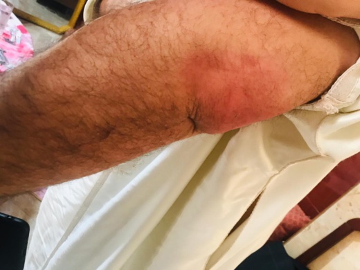 الناموس بالناظور يرسل مواطنا إلى المستعجلات 