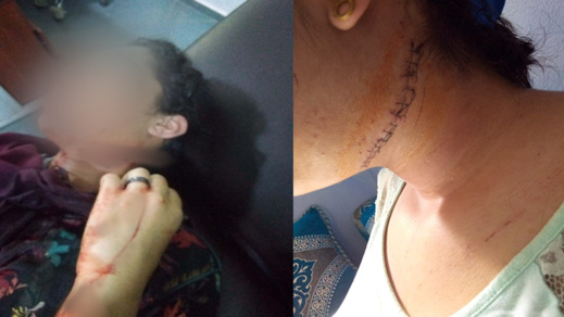 خطير.. اعتداء مميت على فتاة في السادسة عشر من عمرها بحي  عاريض