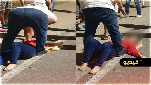 حادثة سير خطيرة ترسل شابة بين الحياة والموت للمستشفى الإقليمي بالناظور