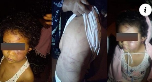 خطير.. أم تعذب بنتها بكويها وثقب أذنيها بقضيب تهز مواقع التواصل الاجتماعي خطير.. أم تعذب بنتها بكويها وثقب أذنيها بقضيب تهز مواقع التواصل الاجتماعي