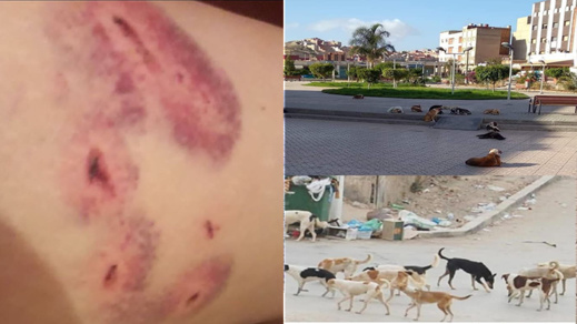 الكلاب الضالة بشوارع أزغنغان ترسل سيدتين الى المستشفى والساكنة تطالب عامل الإقليم التدخل عاجلا الكلاب الضالة بشوارع أزغنغان ترسل سيدتين الى المستشفى والساكنة تطالب عامل الإقليم التدخل عاجلا