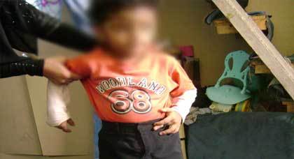 في خطوة حسنة مصور اسباني يسعى لجمع 2000 يورو لعلاج طفل أمازيغي من تشوهات خلقية في خطوة حسنة مصور اسباني يسعى لجمع 2000 يورو لعلاج طفل أمازيغي من تشوهات خلقية