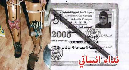 حورية كندوز تناشد المحسنين لمساعدتها على اقتناء قدمين اصطناعيين حورية كندوز تناشد المحسنين لمساعدتها على اقتناء قدمين اصطناعيين