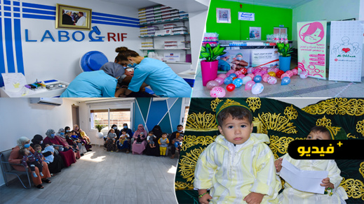 استفادة 65 طفلا من حملة ختان مجانية بالناظور 