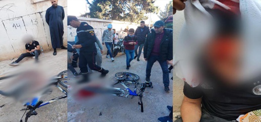 قاصر يتعرض لاعتداء شنيع بالسلاح الأبيض أمام إعدادية الزرقطوني بجعدار قاصر يتعرض لاعتداء شنيع بالسلاح الأبيض أمام إعدادية الزرقطوني بجعدار