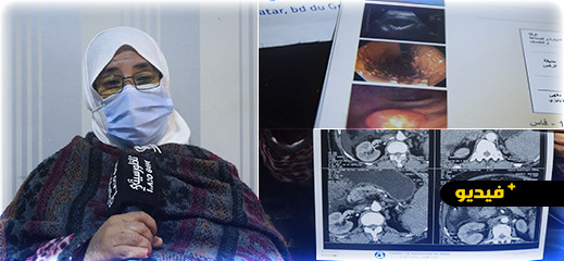 سيدة تعاني أمراضا مزمنة تناشد المحسنين لمساعدتها