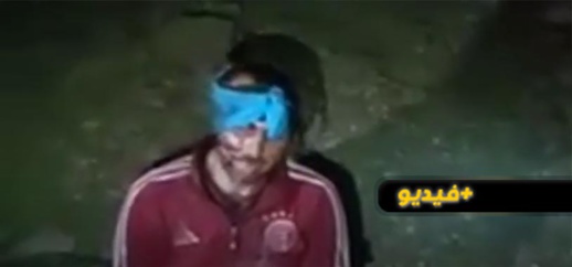 بعد تكبيل امرأة لشاب في الناظور.. سيدة تقطع أذُن خليلها وتحتجزه للزواج منها بعد تكبيل امرأة لشاب في الناظور.. سيدة تقطع أذُن خليلها وتحتجزه للزواج منها