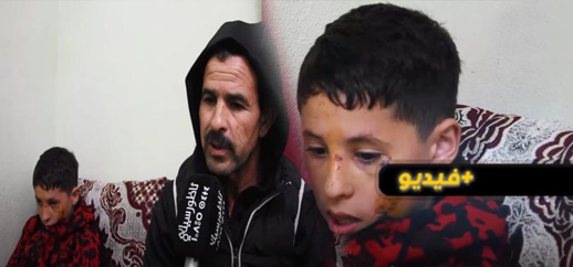 خرج من مدرسة إيكوناف فصدمته دراجة نارية.. والد الطفل زايد يروي تفاصيل الحادثة خرج من مدرسة إيكوناف فصدمته دراجة نارية.. والد الطفل زايد يروي تفاصيل الحادثة