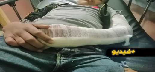سيارة اشهارية لدنيا باطمة تتسبب في حادثة سير مروعة بوجدة سيارة اشهارية لدنيا باطمة تتسبب في حادثة سير مروعة بوجدة
