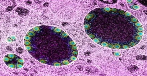 حمضي يحذر من المتفرع الجديد لأوميكرون حمضي يحذر من المتفرع الجديد لأوميكرون