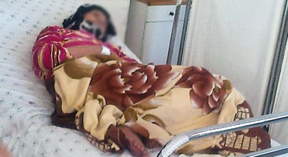 نقل عجوز ستينية إلى المستشفى بعد احتجازها مدة سنة والإتهام موجه لأسرتها بالناظور نقل عجوز ستينية إلى المستشفى بعد احتجازها مدة سنة والإتهام موجه لأسرتها بالناظور