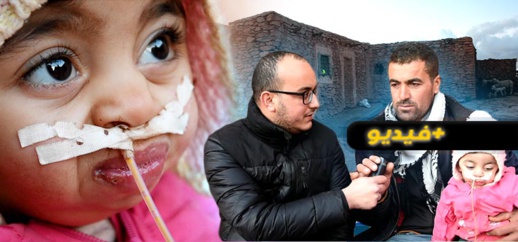 ولدت بفم مغلق.. طفلة تعيش بأنبوب بلاستيكي لعدم قدرتها على الأكل والشرب 