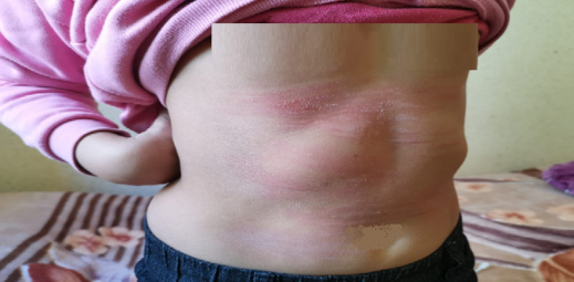 تعنيف تلميذة بالناظور يثير سخطا بمواقع التواصل الاجتماعي والمديرية الإقليمية تستمع للضحية تعنيف تلميذة بالناظور يثير سخطا بمواقع التواصل الاجتماعي والمديرية الإقليمية تستمع للضحية