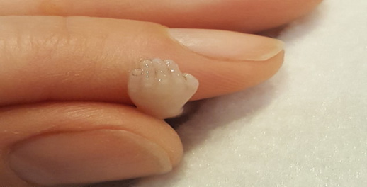 خرج مع أسرته للتنزه.. مهاجر مغربي يعثر على جثة جنين ميت في علبة خرج مع أسرته للتنزه.. مهاجر مغربي يعثر على جثة جنين ميت في علبة