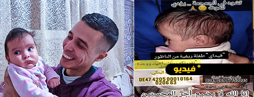 أنقذوا فداء.. طفلة في شهرها الثاني بحاجة لعملية جراحية باهظة بسبب مرض خطير