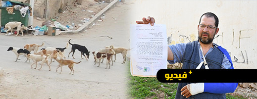 الكلاب الضالة ترسل شخصا إلى مستعجلات الناظور 