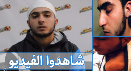 شاب ناظوري يتهم مسؤولا أمنيا بتعذيبه وتعريضه لوابل من الضرب شاب ناظوري يتهم مسؤولا أمنيا بتعذيبه وتعريضه لوابل من الضرب