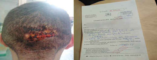 مجرم خطير بعتدي بالسلاح الأبيض على شاب بحي عاريض 