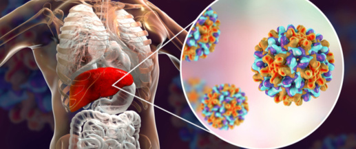 حمضي يكشف أعراض فيروس التهاب الكبد الحاد حمضي يكشف أعراض فيروس التهاب الكبد الحاد