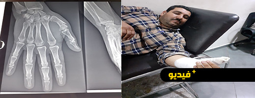 حاميها حراميها، سائق سيارة أجرة بالمحطة المركزية بالناظور، كاد أن يفارق الحياة لمجرد أن طالب سائق نقل مزدوج من مغادرة المحطة حاميها حراميها، سائق سيارة أجرة بالمحطة المركزية بالناظور، كاد أن يفارق الحياة لمجرد أن طالب سائق نقل مزدوج من مغادرة المحطة