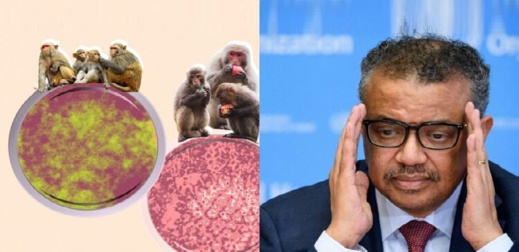جدري القرود.. منظمة الصحة العالمية تكشف عن آخر أعداد الإصابات