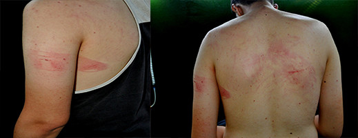 اختطاف طالب بكلية سلوان وتعذيبه في ظروف غامضة