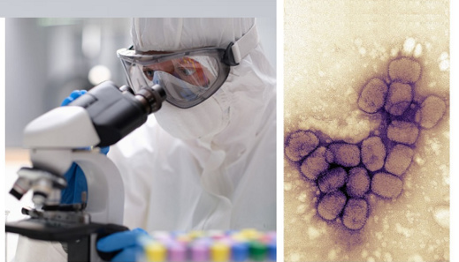 جدري القردة بالمغرب.. الحكومة تتحدث عن الحالة التي ظهرت وهذه مستجداتها جدري القردة بالمغرب.. الحكومة تتحدث عن الحالة التي ظهرت وهذه مستجداتها