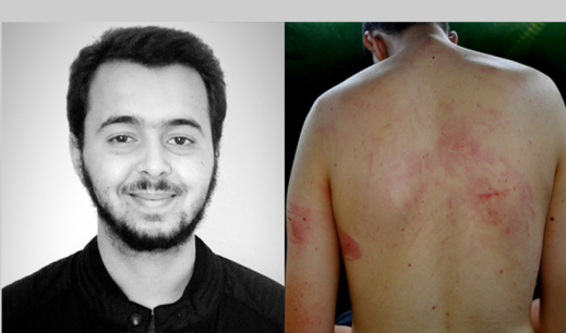 السجن لطالب والسراح لآخر بالناظور على ذمة التحقيق في قضية اختطاف واحتجاز وتعذيب السجن لطالب والسراح لآخر بالناظور على ذمة التحقيق في قضية اختطاف واحتجاز وتعذيب