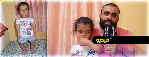 بثينة.. طفلة تبلغ 8 سنوات يتطلب علاجها كسر قدميها ورجليها ووالدها يناشد المساعدة من ذوي القلوب الرحيمة بثينة.. طفلة تبلغ 8 سنوات يتطلب علاجها كسر قدميها ورجليها ووالدها يناشد المساعدة من ذوي القلوب الرحيمة