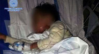 الأمن الإسباني بمليلية ينقذ طفلة في الرابعة من بلدة فرخانة تعرضت لحروق خطيرة