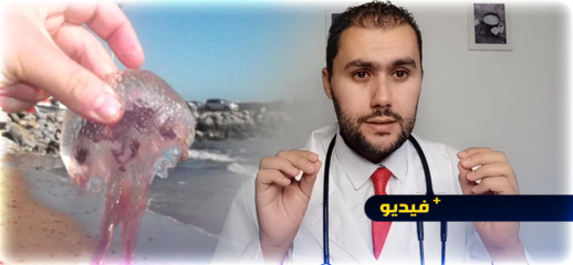 الدكتور أبركان يقدم نصائح بالأمازيغية حول ما يجب القيام به عند التعرض للسعة قنديل البحر
