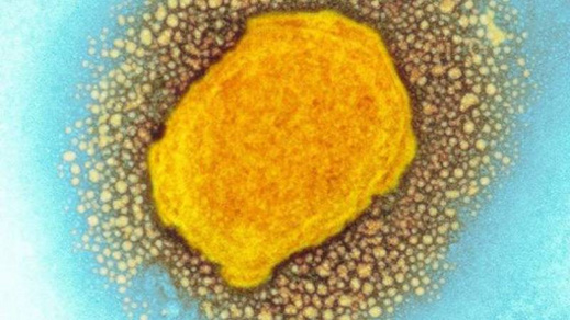 إسبانيا تسجل ثاني حالة وفاة بجدري القردة إسبانيا تسجل ثاني حالة وفاة بجدري القردة