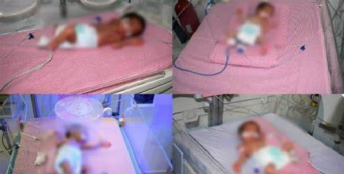 غير بعيد عن الناظور.. سيدة عشرينية تنجب 4 توائم إناث