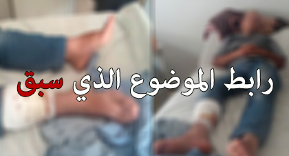 متابعة: القائد الجهوي للدرك الملكي بتازة لم يضغط على الشاب الناظوري للتنازل للعصابة التي اعتدت عليه متابعة: القائد الجهوي للدرك الملكي بتازة لم يضغط على الشاب الناظوري للتنازل للعصابة التي اعتدت عليه