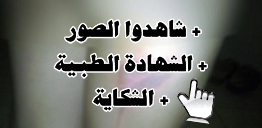 طليقة تُعذّب ابنها القاصر وتَكْويهِ بواسطة آلة "البْلانْتشَا" في أنحاء من جسمه